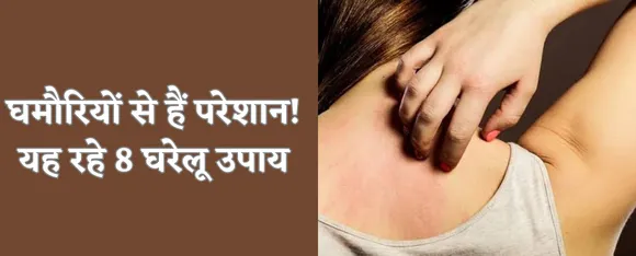 8 home remedies to get rid of heat rash