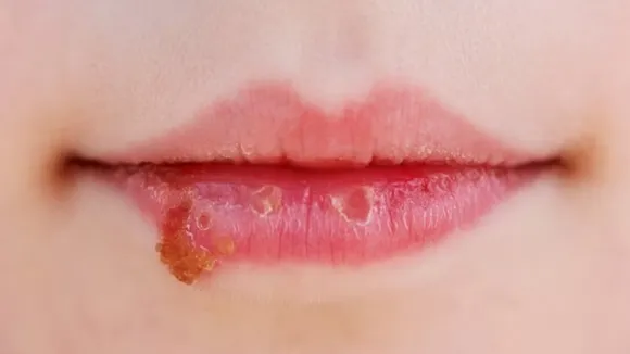v