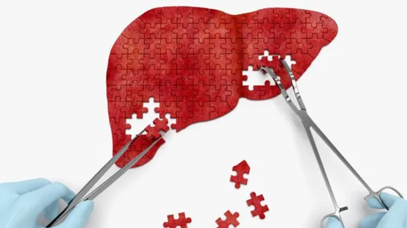 Ways to reduce liver infection 