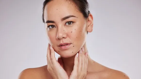 Dry Skin 