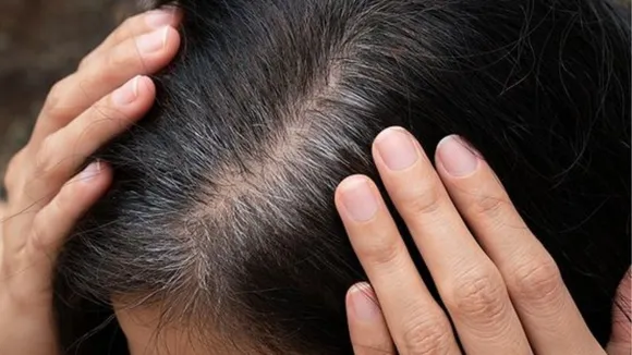 Grey Hair (Pinterest).png