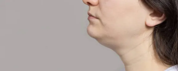 reduce neck fat