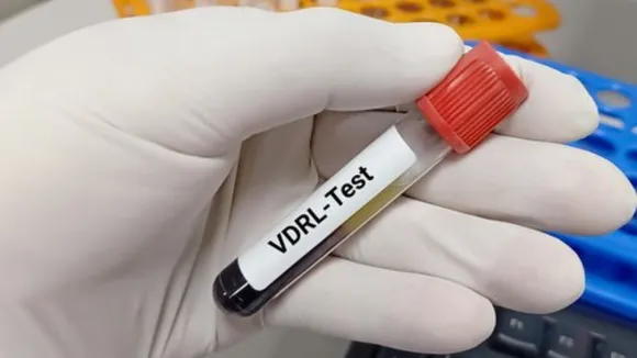 VDRL test