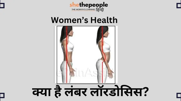 lumber lordosis).jpg