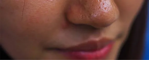 png_20230616_110147_0000.png