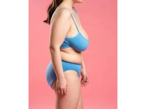 Sagging Breasts