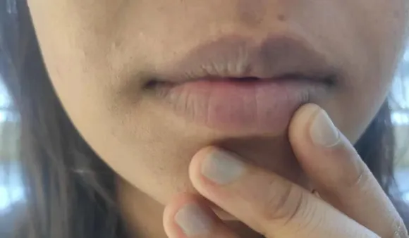lips(Derma Essentia).png 