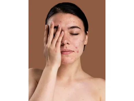 Beauty During Menopause2