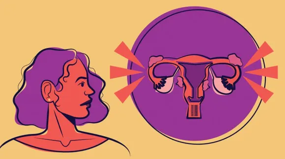 endometriosis