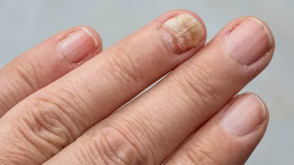 Nail colour vh