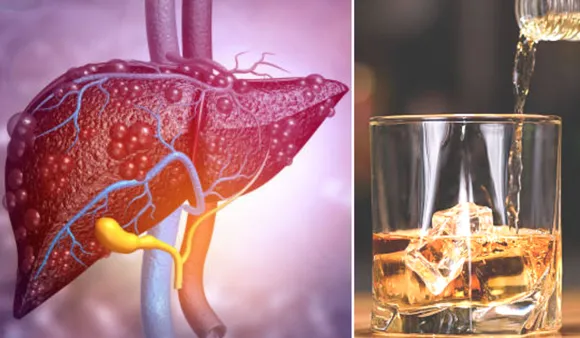 Worse For Liver(Navbharat times)