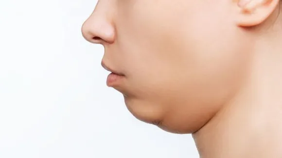 Exercise to reduce double chin