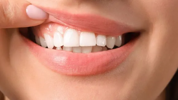 Five Vitamins and Minerals For Strong Teeth