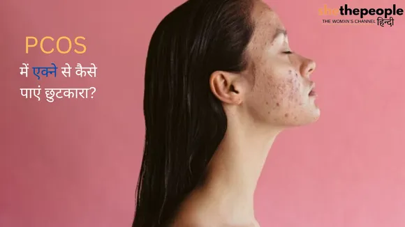 Acne During PCOS