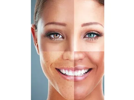 Moisturizer For Combination Skin
