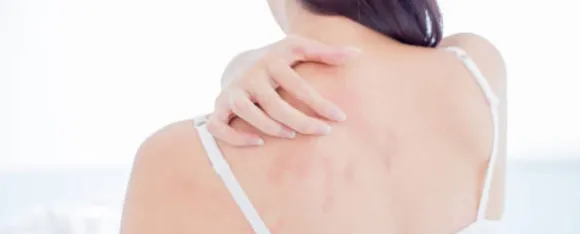 itchy skin