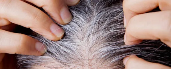 White hair