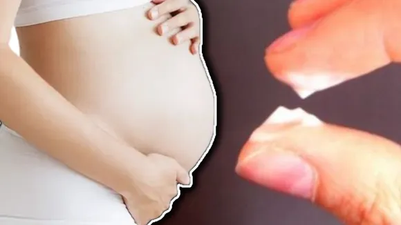 White discharge pregnancy 