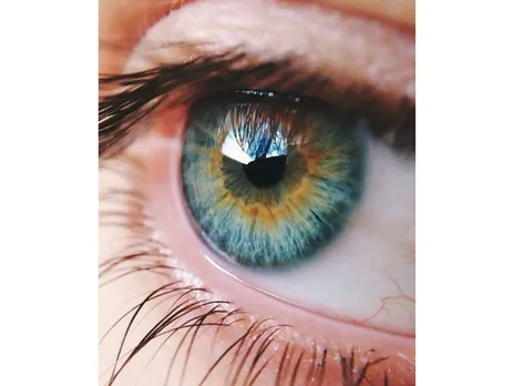 Rarest Eye Color