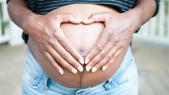 Reduce Stretch Marks