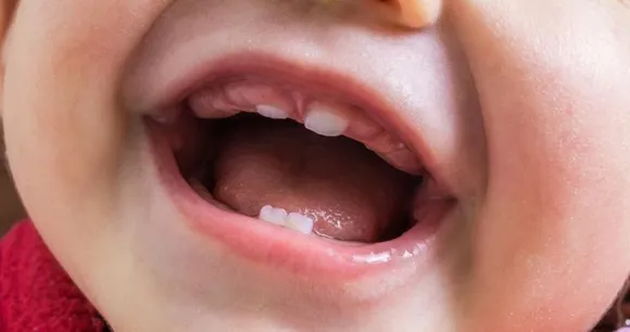 Newborn first tooth