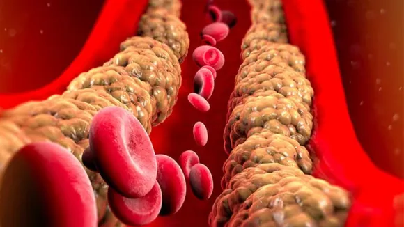 Effective Ways to Lower Your Cholesterol Levels 