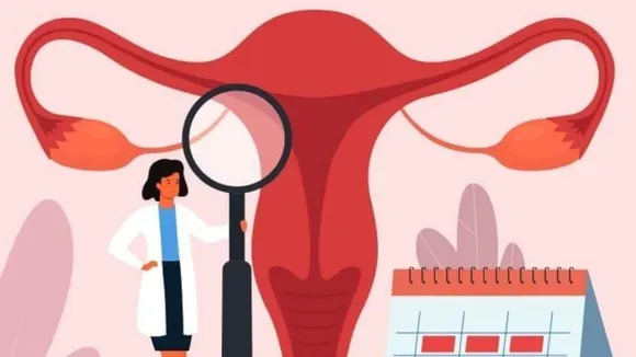 5 signs of irregular periods 