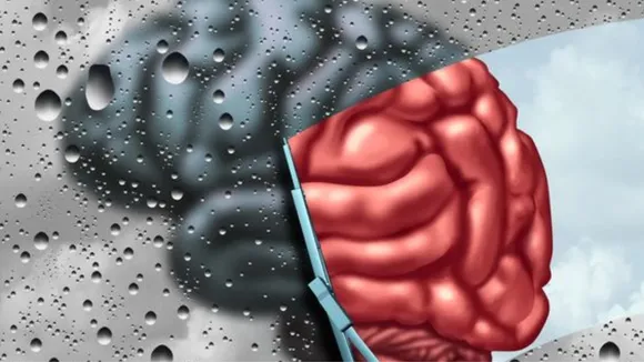 Brain Fog (Pinterest).png