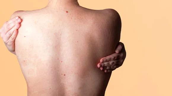 human body diseases(freepik)