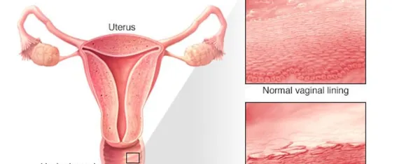Vagina img.png