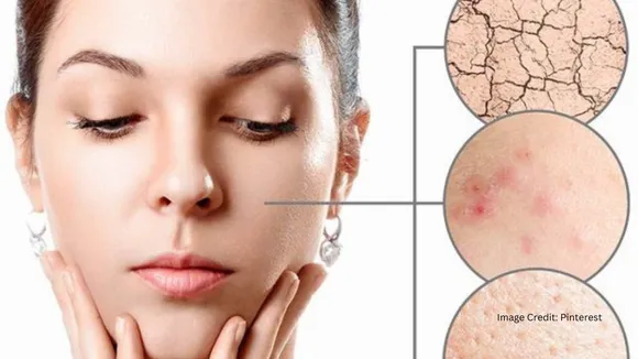 Seasonal Skin Care