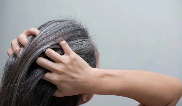 White Hair Problem Remedies: कम उम्र में ही बाल हो रहे हैं सफेद तो अपनाएं ये घरेलू नुस्खे