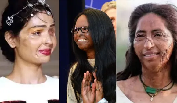 5 Acid Survivors With Unbreakable Determination: 5 एसिड अटैक सर्वाइवर जो लड़कियों के लिए बनी उम्मीद