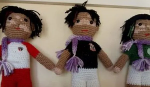 World Vitiligo Day 2021 : विटिलिगो क्या होता है ? जानिए जरूरी बातें