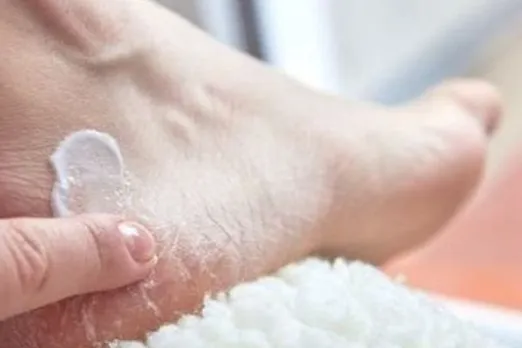 Remedies for Cracked Heels: फटी एड़ियों को कोमल बनाने के 5 उपाय