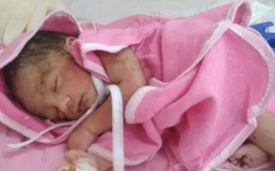 इस वजह से होते है बच्चे के सिर के आकार अलग-अलग, जानिए इसका इलाज