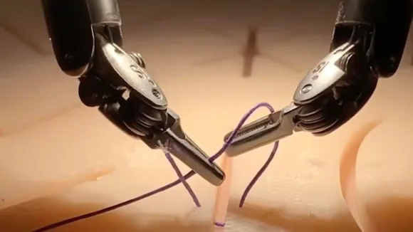 Robotic Surgery to be launched at SSKM Hospital in Kolkata: কলকাতার এসএসকেএম হাসপাতালে রোবোটিক সার্জারি