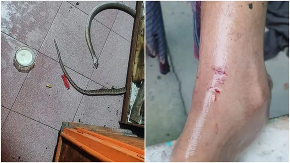 Snake Bite Lifestyle: বর্ষায় সাপের প্রকোপ বাড়ে। 