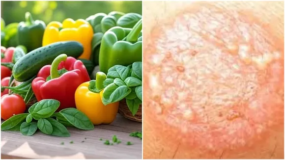 Cure Ringworm
