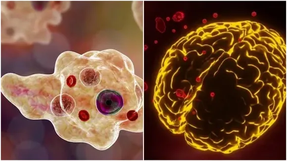 Deadly brain-eating amoeba