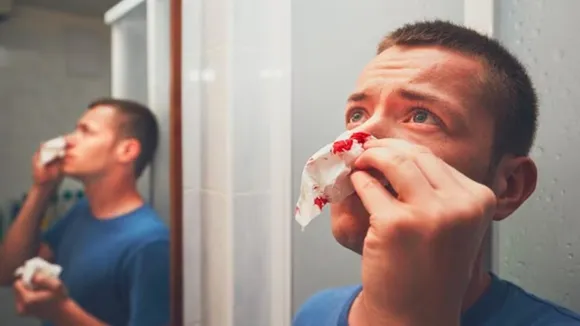 nosebleed causes  e,pistaxis treatment,  when is a nosebleed serious,  high blood pressure nosebleed  ,frequent nosebleeds warning signs  ,how to stop a nosebleed , ENT specialist advice  ,Aster CMI Hospital,  nosebleed first aid,  nosebleed prevention tips,নাক দিয়ে রক্ত পড়া কারণ  ,নোজব্লিড কতটা বিপজ্জনক  ,এপিস্ট্যাক্সিস চিকিৎসা  ,উচ্চ রক্তচাপ ও নাকের রক্তপাত,  বারবার নাক দিয়ে রক্ত পড়া  ,নোজব্লিড থামানোর উপায়  ,নাকের রক্তপাতের প্রাথমিক চিকিৎসা,  ড্রাই এয়ার নোজব্লিড,  চিকিৎসকের পরামর্শ নাকের রক্তপাত,  নোজব্লিড প্রতিরোধ