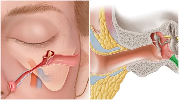 Tinnitus Warning Signs: উপেক্ষা করলেই বিপদ।