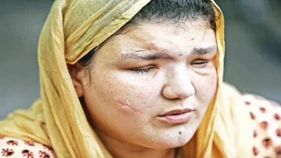 Khatera Hashmi Afgan woman assaulted by Taliban story of extreme oppression