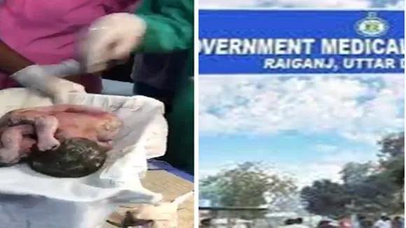 A child take birth in raiganj hospital, who have with two head, four hand anf four leg