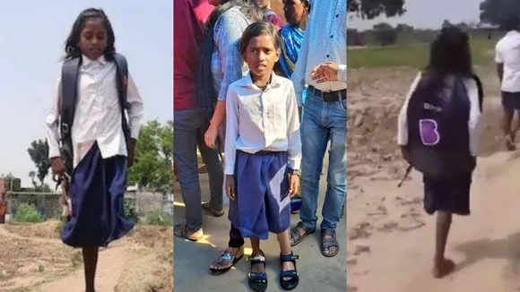 Bihar girl gets prosthetic leg