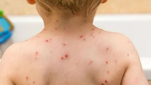 protect your child from money pox