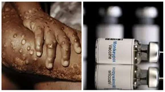 icmr is prepared for monkeypox