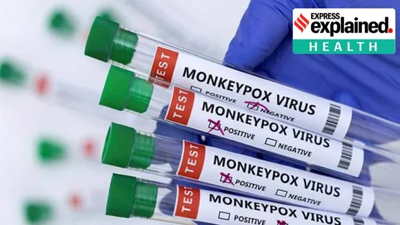 monkeypox in india, monkeypox who alarm, monkeypox 4th case india, monkeypox delhi case, monkeypox case reported delhi, what is monkeypox, monkeypox symptoms, monkeypox explained, express explained, explained health, indian express