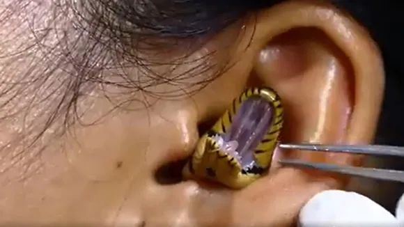 snake video,snake videos,Snake Video Viral,Snake video is going viral,Small Snake,small snake eats big snake,Snake Inside The Ear,Shocking Video,Facebook Video,Snake Species,Snake Viral Video,Dangerous Snake Video,ear,saap,sanp,kaan m saap,kaan m sanp
