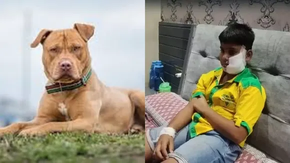 dog bites man Ghaziabad, Ghaziabad man bitten, Raj Nagar Extension, Ghaziabad news, Delhi news, Delhi news today, Indian Express, Indian Express news, Ghaziabad local news"